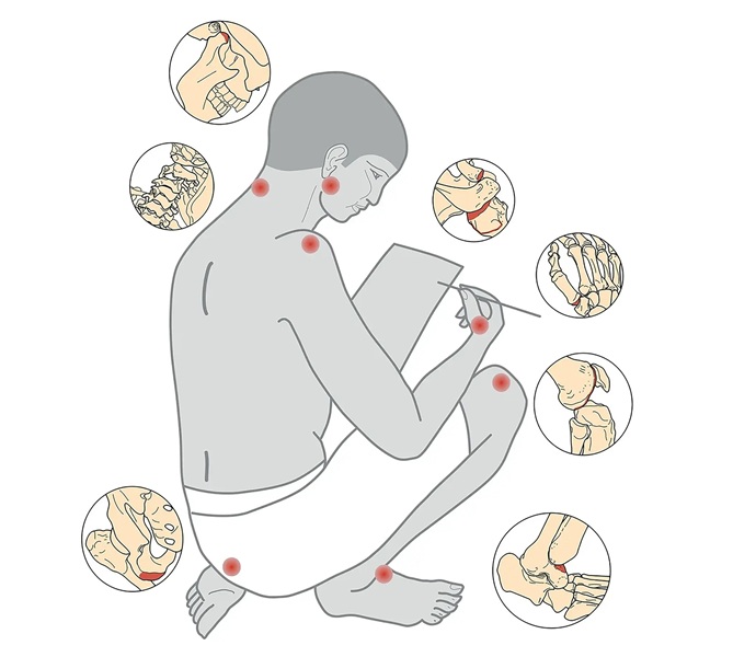 اسکلتهای کاتبان در مقایسه با اسکلتهای غیرکاتبان، آسیب بیشتری به بخشهای خاصی از بدن نشان میدادند.